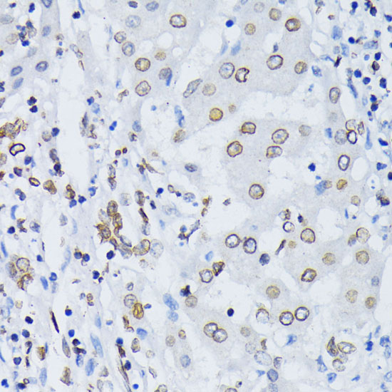 LMNB1 Antibody