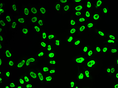 SNRPA antibody