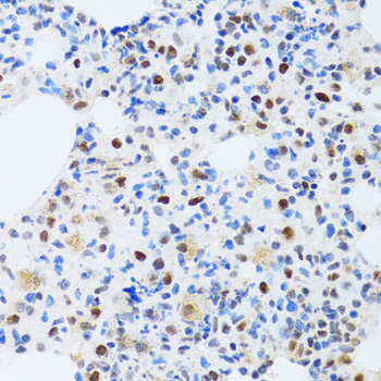 MTA3 antibody