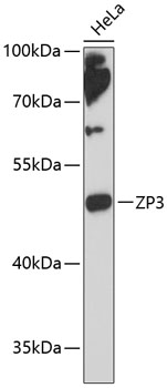 ZP3 Polyclonal Antibody