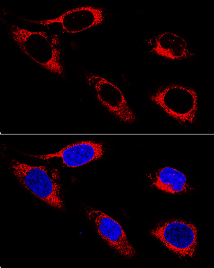 P4HB Antibody