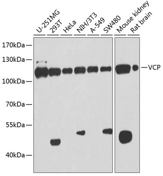 VCP antibody