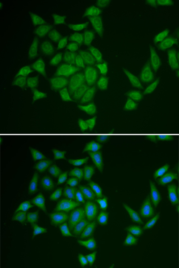 AMPD3 antibody