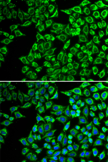 LIPC Antibody