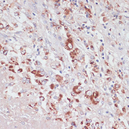 LYZ Polyclonal Antibody