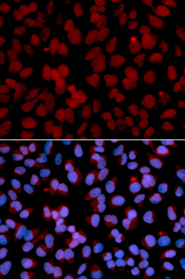 TNFAIP3 Antibody