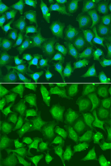 XRCC2 Antibody