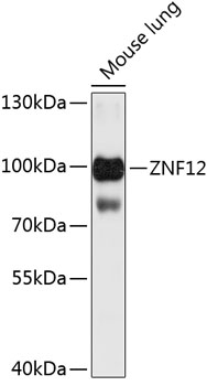 ZNF12 Polyclonal Antibody