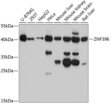 ZNF396 Polyclonal Antibody