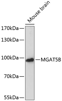MGAT5B Polyclonal Antibody