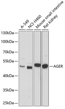 AGER Antibody