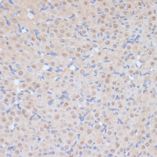 CDK9 Antibody