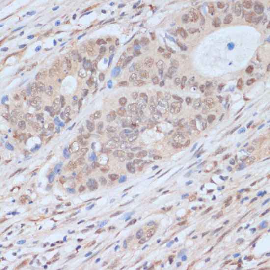 CDK9 Antibody