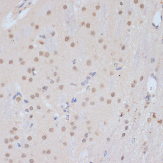 CDK9 Antibody