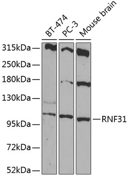 RNF31 Polyclonal Antibody