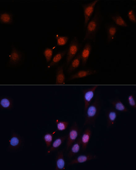 SMAD5 Antibody