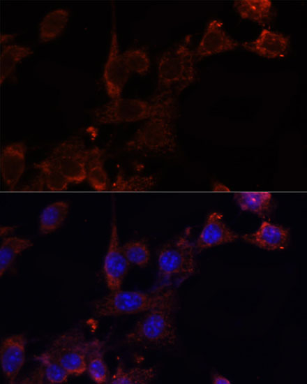 NRF1 Antibody