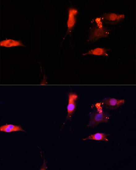 NRF1 Antibody