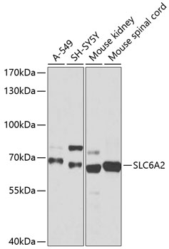 SLC6A2 Polyclonal Antibody
