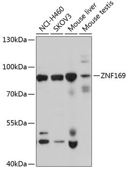 ZNF169 Polyclonal Antibody