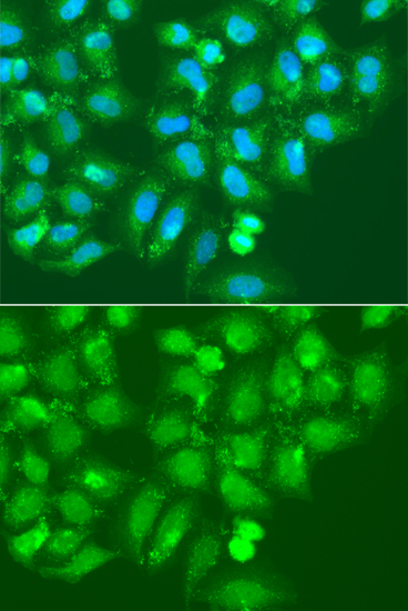 AMY2B Polyclonal Antibody