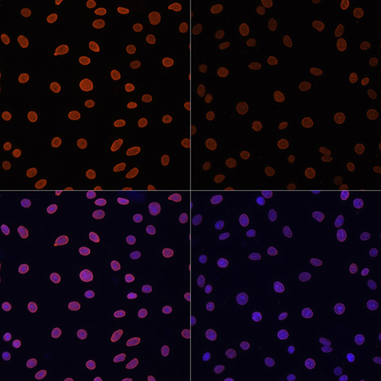 Acetyl-Histone H4-K12 pAb