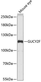 GUCY2F Polyclonal Antibody