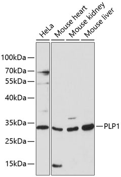 PLP1 Polyclonal Antibody