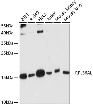 RPL36AL Polyclonal Antibody