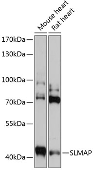 SLMAP Polyclonal Antibody