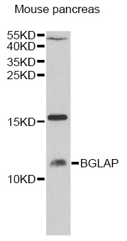 BGLAP Rabbit Polyclonal Antibody