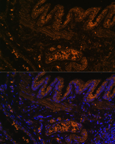 MMP9 antibody