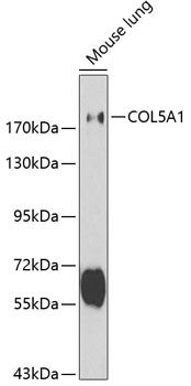 COL5A1 Antibody