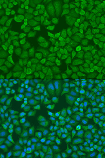 IGF2BP1 Antibody