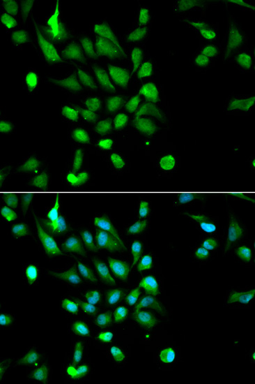 PSMC5 Antibody