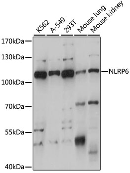 NLRP6 Rabbit Polyclonal Antibody