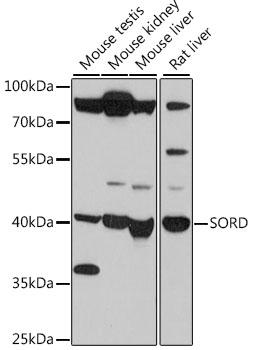 SORD Antibody