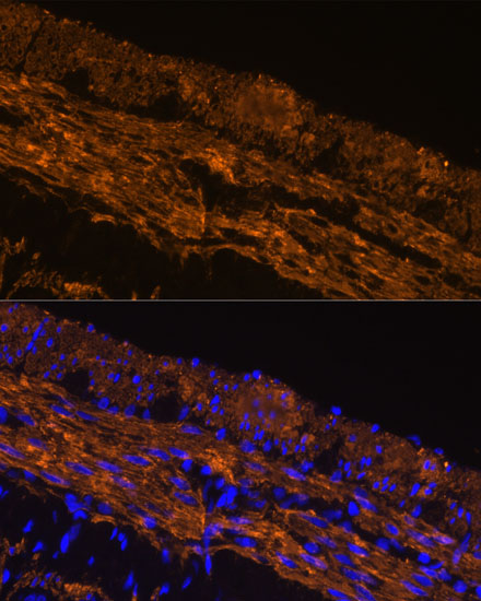 ACTA2 antibody