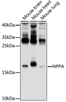 NPPA Antibody