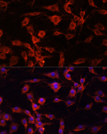 SERPINA1 Antibody