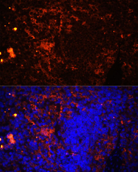 ITGAL Antibody