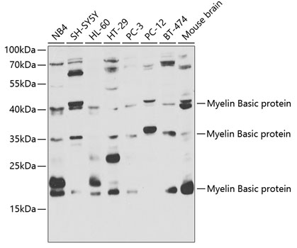 MBP Antibody