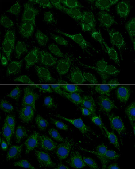 FXN Antibody