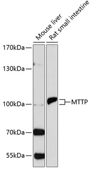 MTTP antibody