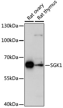 SGK1 Antibody