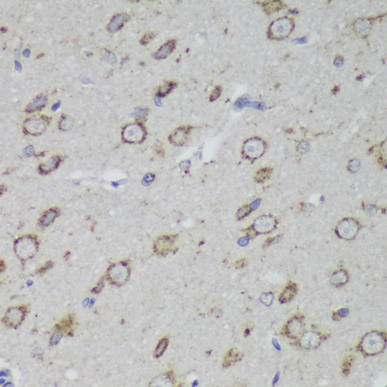 PSAP Antibody