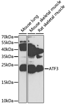 ATF3 Antibody