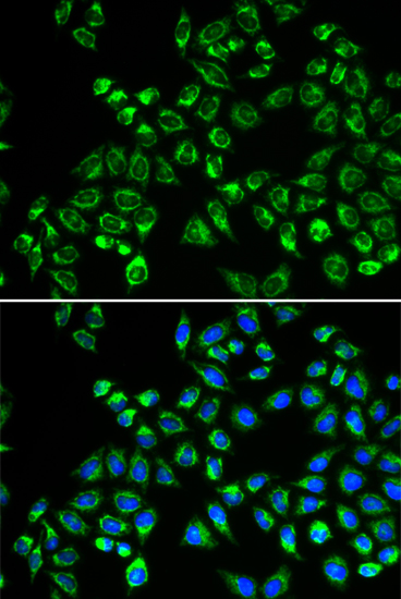 C1QBP Antibody