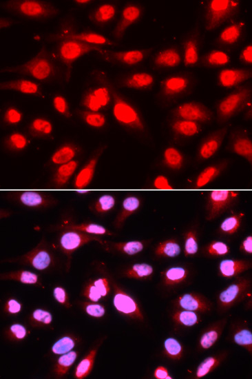 U2AF2 Antibody