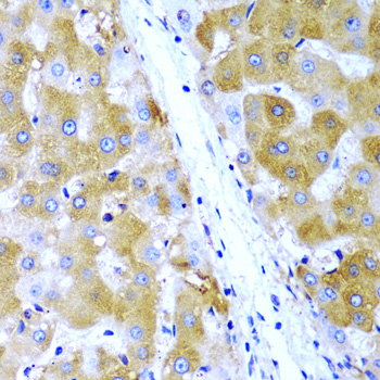 TIRAP antibody